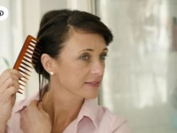 Hair loss: how does it affect women?